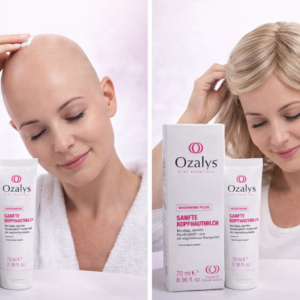 Kopfhautpflege Creme - 70 ml  - Ozalys