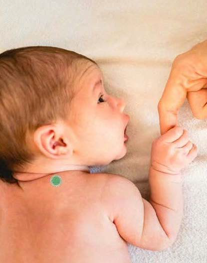 T-PATCH® Klebethermometer für Neugeborene 32 ST.